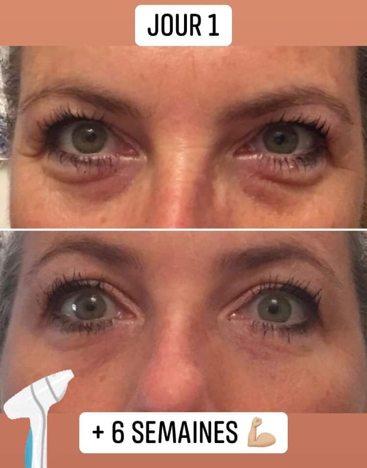 Crème contour des yeux qui va avec l'embout de la brosse nettoyante