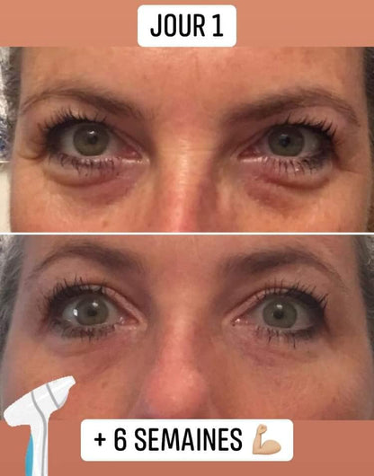 Crème contour des yeux qui va avec l'embout de la brosse nettoyante